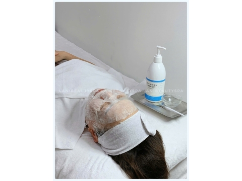 Khách điều trị mụn tại Spa