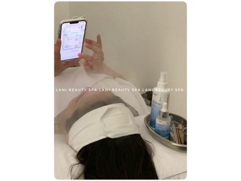 Khách điều trị mụn tại Spa