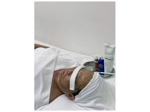 Khách điều trị mụn tại Spa